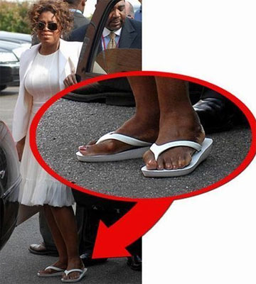 Oprah WInfrey in flip flops showing her extra toe.