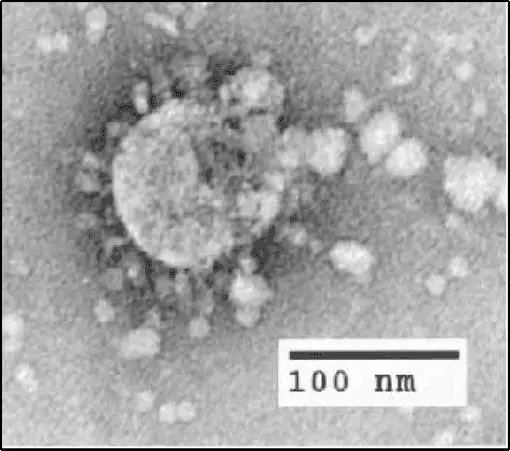 SARS virus under the electron microscope that looks like a sphere but with small tentacles surrounding it.